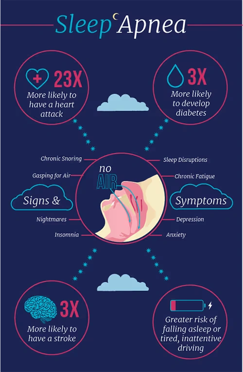 sleep apnea