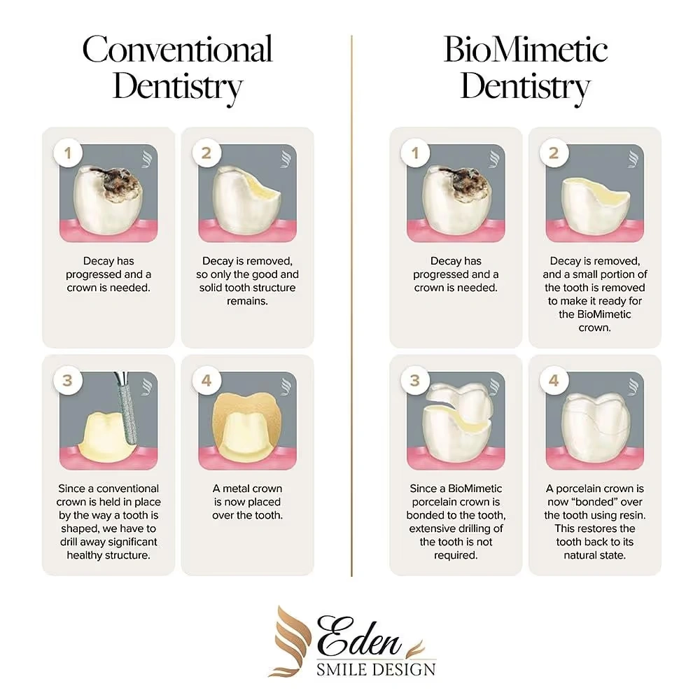 Conventional Dentistry vs BioMimetic Denstistry