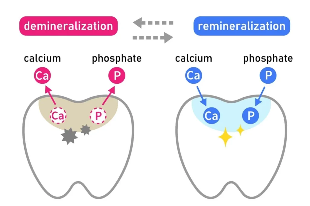 What is Fluoride & How Does it Protect Your Smile?