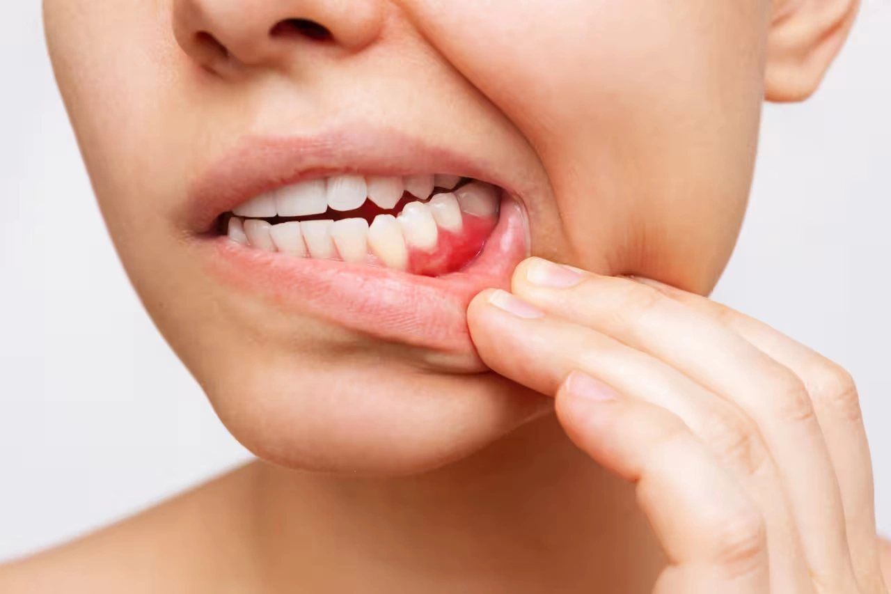 The Surprising Link Between Gum Disease and Fertility: What NYC Patients Should Know