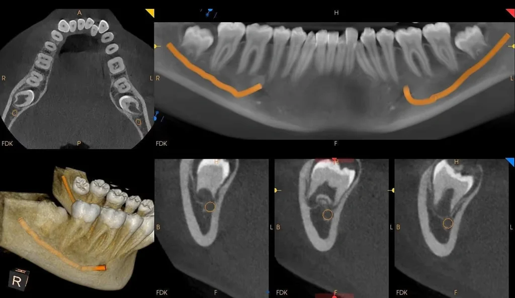 How 3D Imaging Elevates Modern Dental Diagnosis