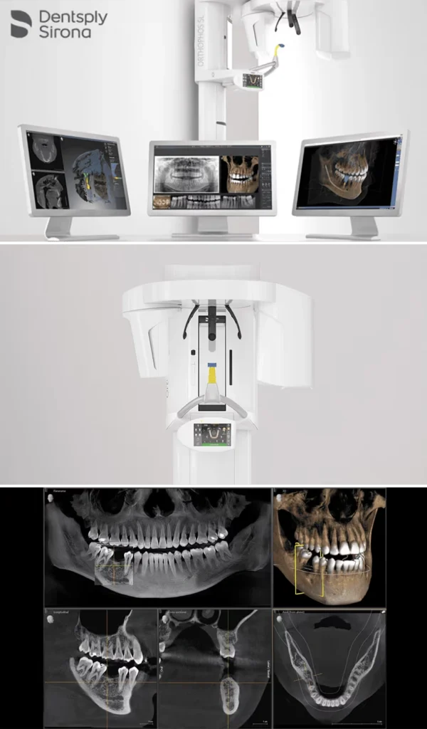 CBCT Technology