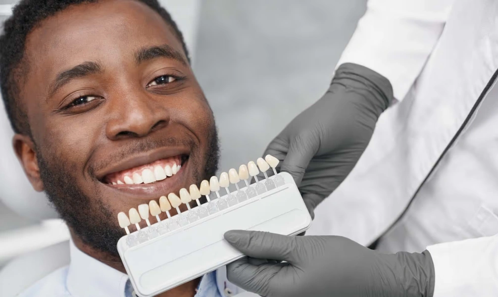 Dentist comparing porcelain laminate veneer shades with a patient