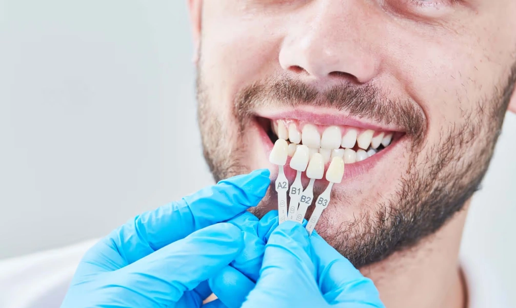 Dentist matching porcelain veneer shades during smile restoration