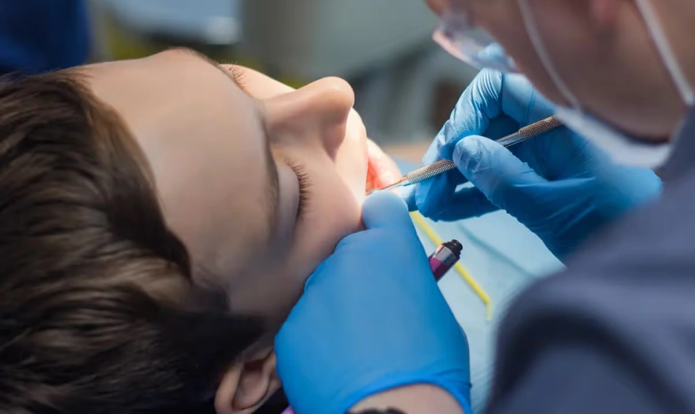 Dentist applying dental sealants to a patient's teeth