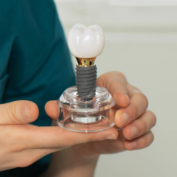 Dental implant restoration displayed on a dental model