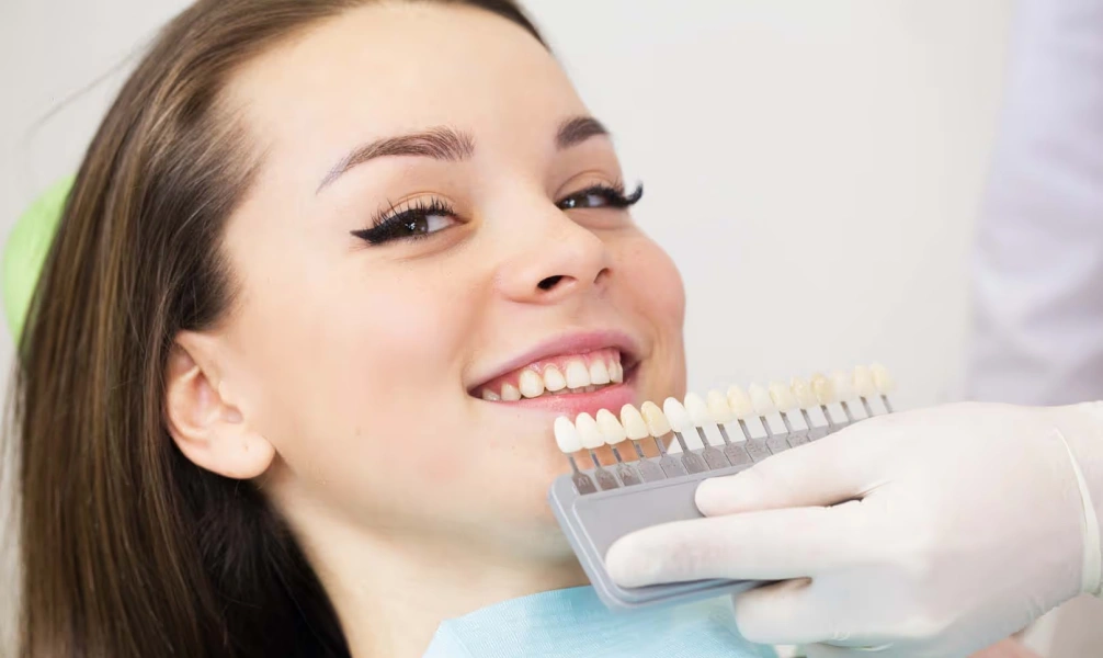 Dentist comparing porcelain veneer shades with a patient's natural teeth