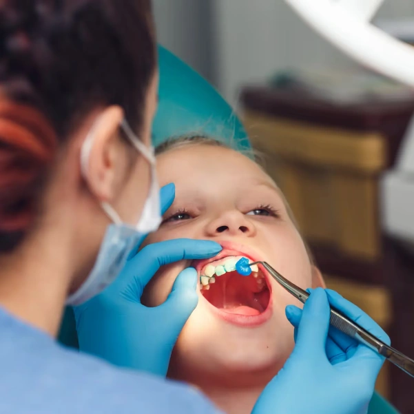 Child receiving a professional fluoride treatment at the dental office