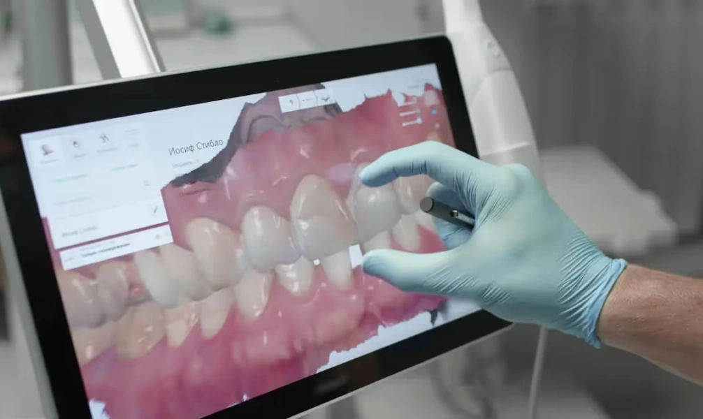 Dentist reviewing a digital 3D dental scan on a monitor