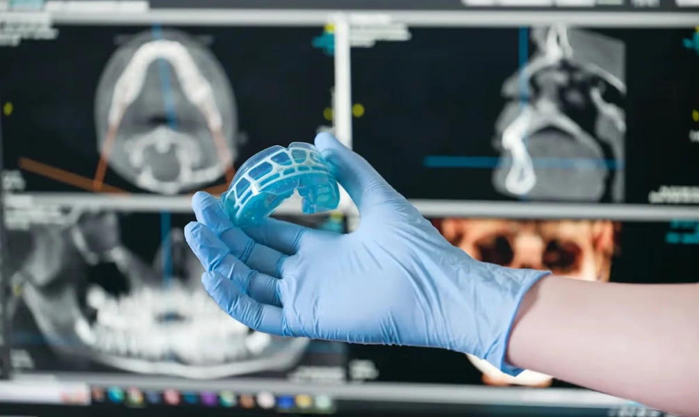 Dental oral appliance designed to help reduce snoring