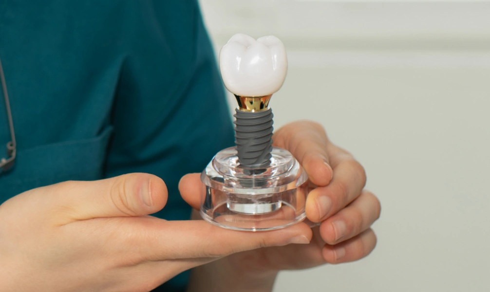 Dental implant restoration displayed on a dental model